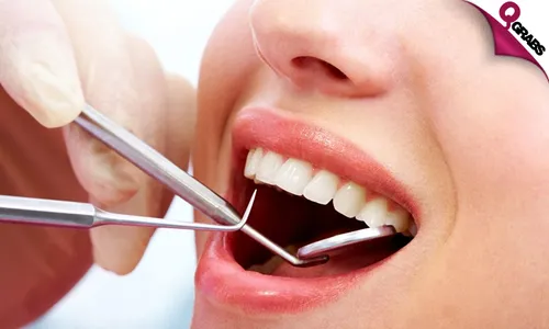 Teeth Scaling, Polishing & Consultation!